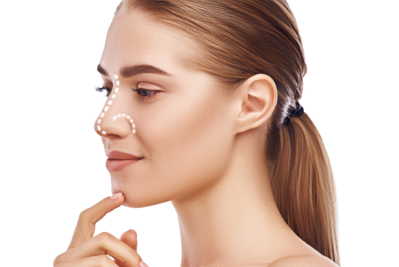 Leia mais sobre o artigo Rinoplastia estruturada preservando a naturalidade do rosto